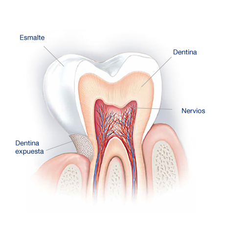What Causes Sensitive Teeth? What Causes Sensitive Teeth?