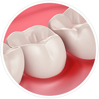 Salud de las Encías y Sensibilidad Dental Salud de las Encías y Sensibilidad Dental